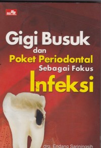 Gigi Busuk dan Poket Periodental sebagai Fokus Infeksi